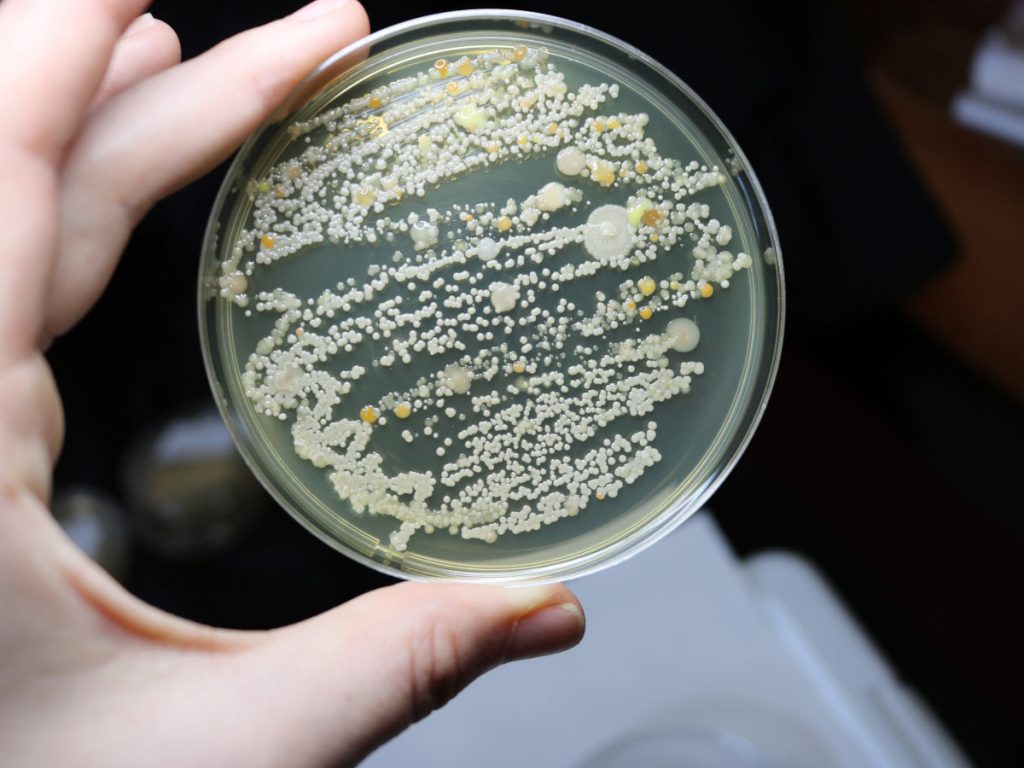 petri dish home mold testing kit positive results